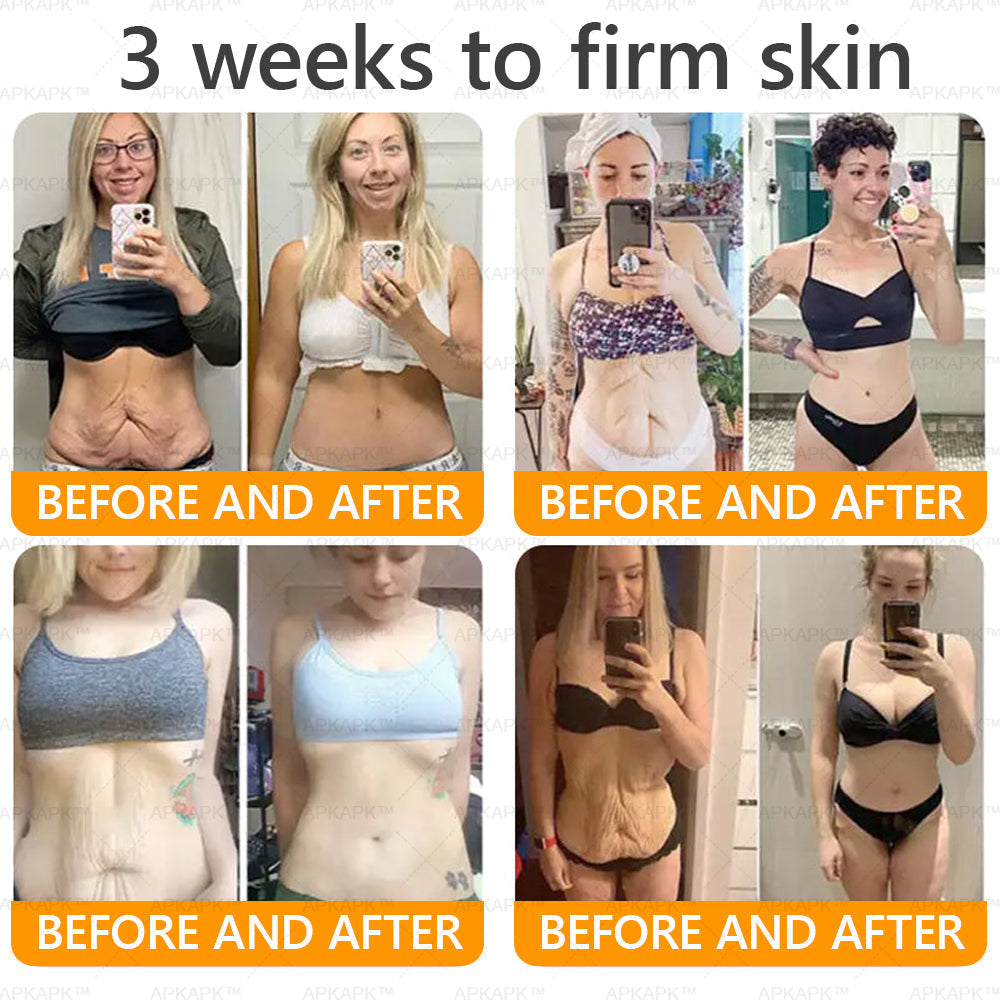 Made and Shipped from USA ✨  Bee venom Comprehensive Cream 🔥 LAST DAY 80% OFF 💎💎