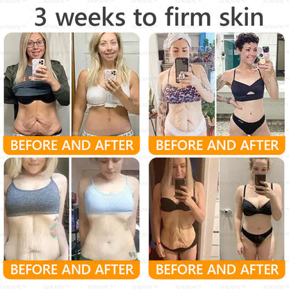 Made and Shipped from USA ✨  Bee venom Comprehensive Cream 🔥 LAST DAY 80% OFF 💎💎