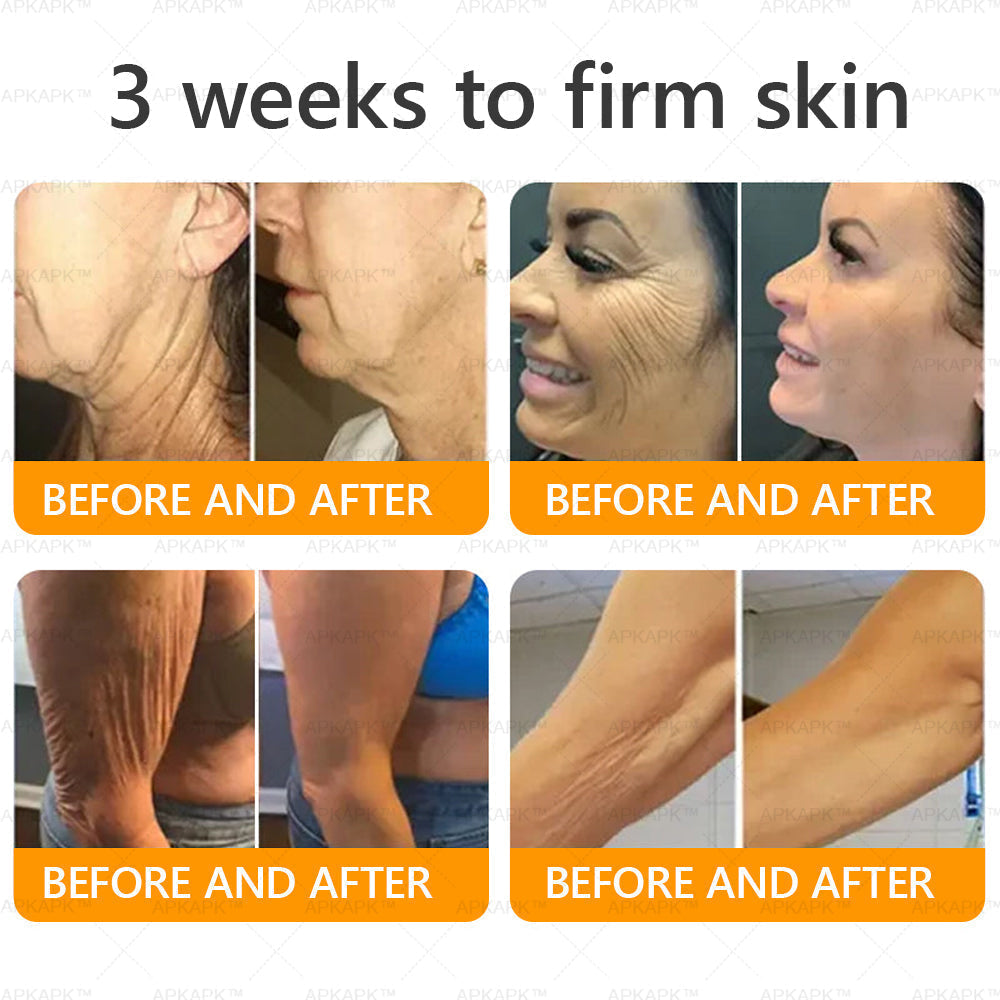 Made and Shipped from USA ✨  Bee venom Comprehensive Cream 🔥 LAST DAY 80% OFF 💎💎