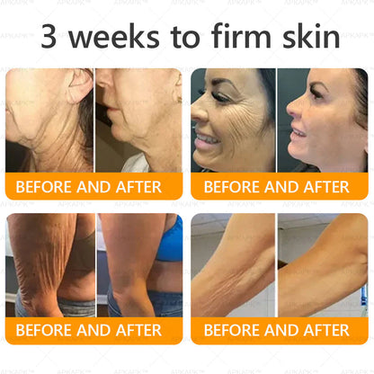 Made and Shipped from USA ✨  Bee venom Comprehensive Cream 🔥 LAST DAY 80% OFF 💎💎