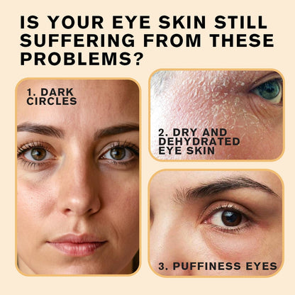 Castor Oil ball Eye Serum – Fade Wrinkles & Banish Bags Naturally