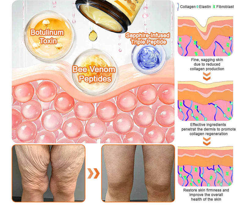 Made and Shipped from USA ✨  Bee venom Comprehensive Cream 🔥 LAST DAY 80% OFF 💎💎