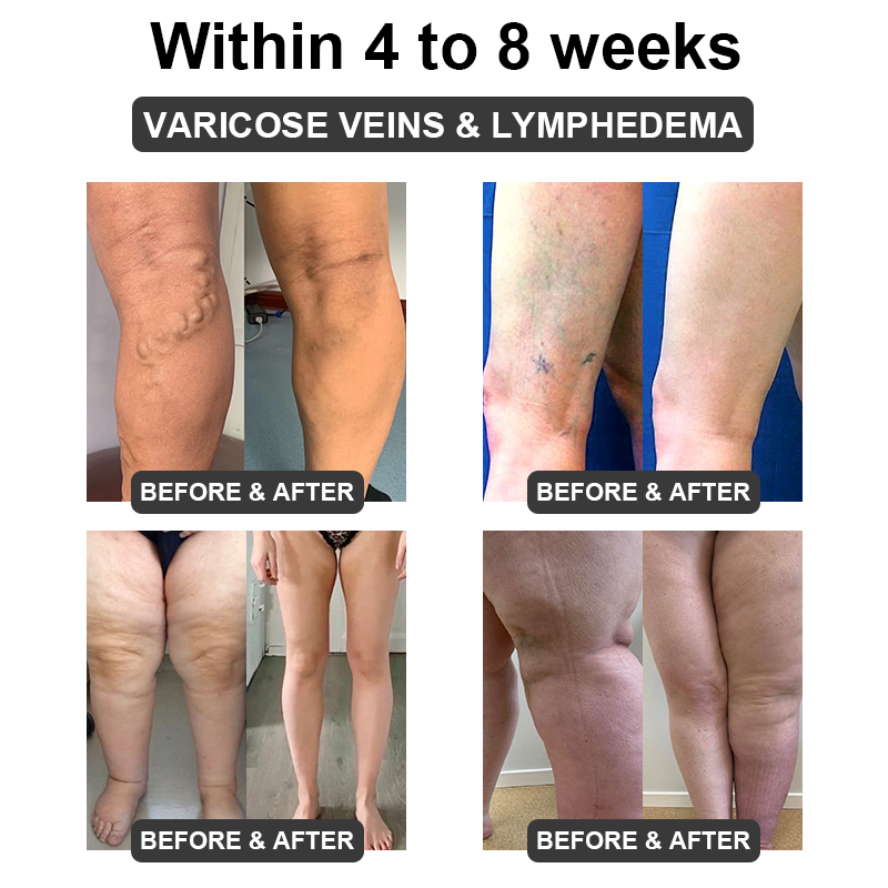 ✅ Official Store: QAIWI™ Ultrasound Cavitation & Detoxification Wristband (👨‍⚕️ Recommended by the Diabetes Association)