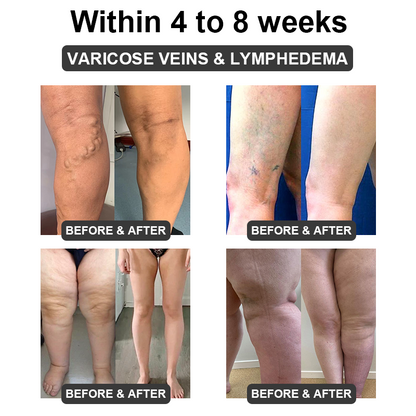 ✅ Official Store: QAIWI™ Ultrasound Cavitation & Detoxification Wristband (👨‍⚕️ Recommended by the Diabetes Association)