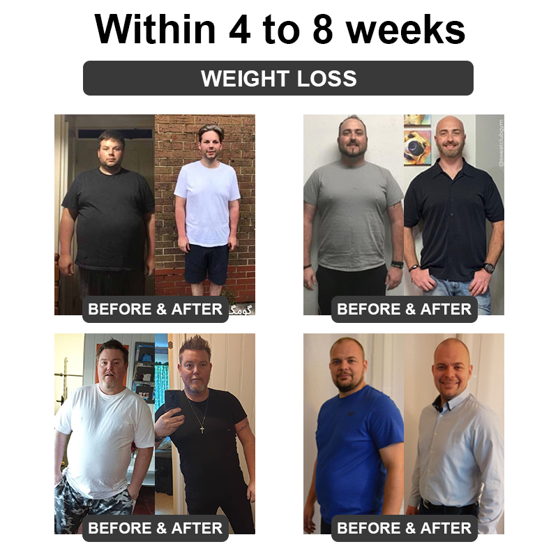 ✅ Official Store: QAIWI™ Ultrasound Cavitation & Detoxification Wristband (👨‍⚕️ Recommended by the Diabetes Association)