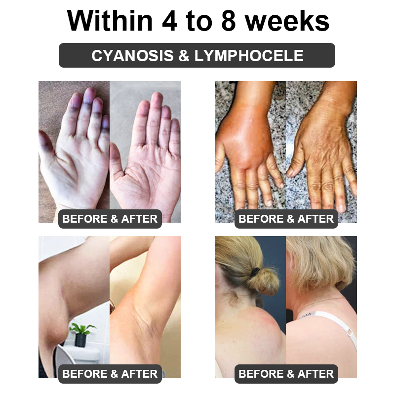 ✅ Official Store: QAIWI™ Ultrasound Cavitation & Detoxification Wristband (👨‍⚕️ Recommended by the Diabetes Association)