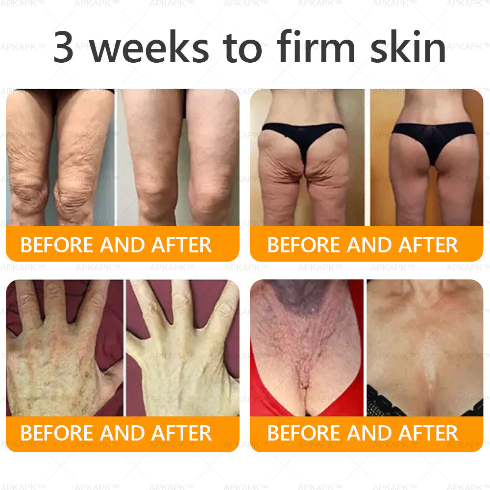 Made and Shipped from USA ✨  Bee venom Comprehensive Cream 🔥 LAST DAY 80% OFF 💎💎