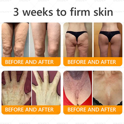 Made and Shipped from USA ✨  Bee venom Comprehensive Cream 🔥 LAST DAY 80% OFF 💎💎