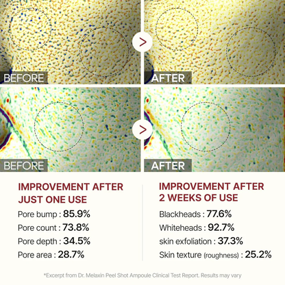 Rice Peel Glow Serum Ampoule