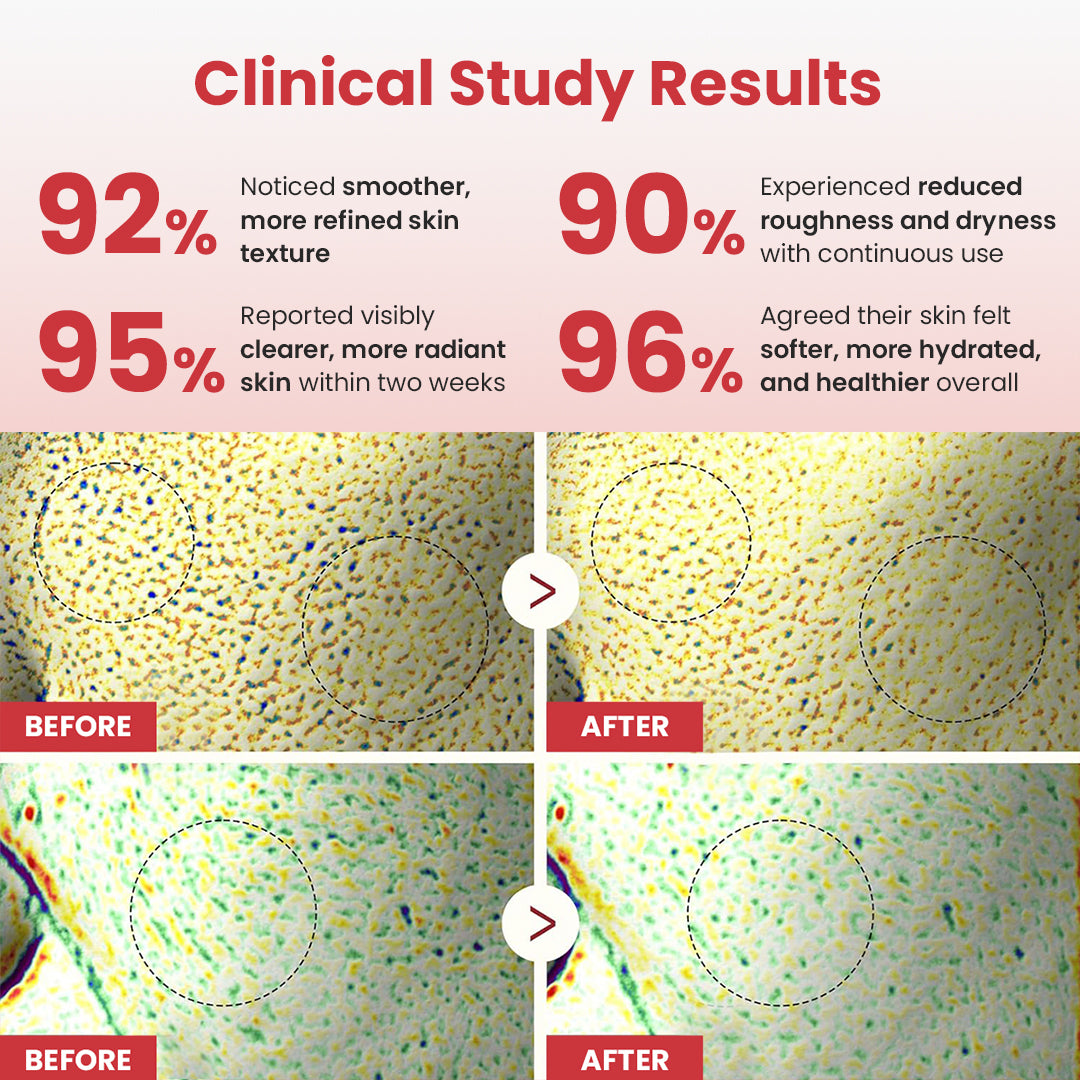 Hypochlorous Acid Rice Duo For Face & Body | Gentle Exfoliating Serum for Dead Skin Cells & Pore Care, Blackheads & Excess Sebum Control | Rice Extract, Hypochlorous, Panthenol for Hydrating & Smoothing Care